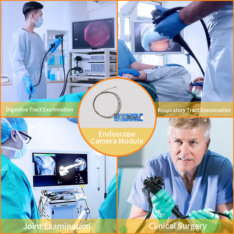 Vista laterale e interfaccia USB: un'analisi dei vantaggi applicativi pratici del modulo telecamera per endoscopio