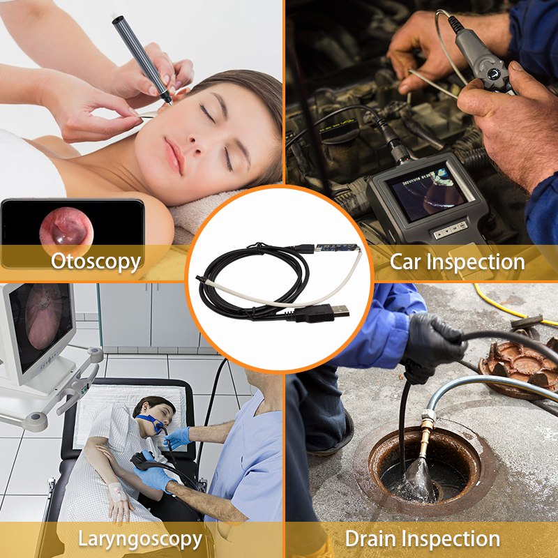 Quelles sont les diff&eacute;rences dans l’application des modules de cam&eacute;ra d’endoscope dans les domaines m&eacute;dical et industriel ?
