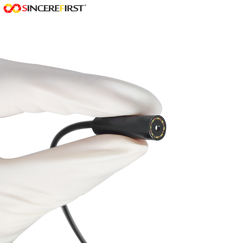 8mm 2MP 의료용 내시경 모듈의 산업 포지셔닝 및 기술 진화 논리