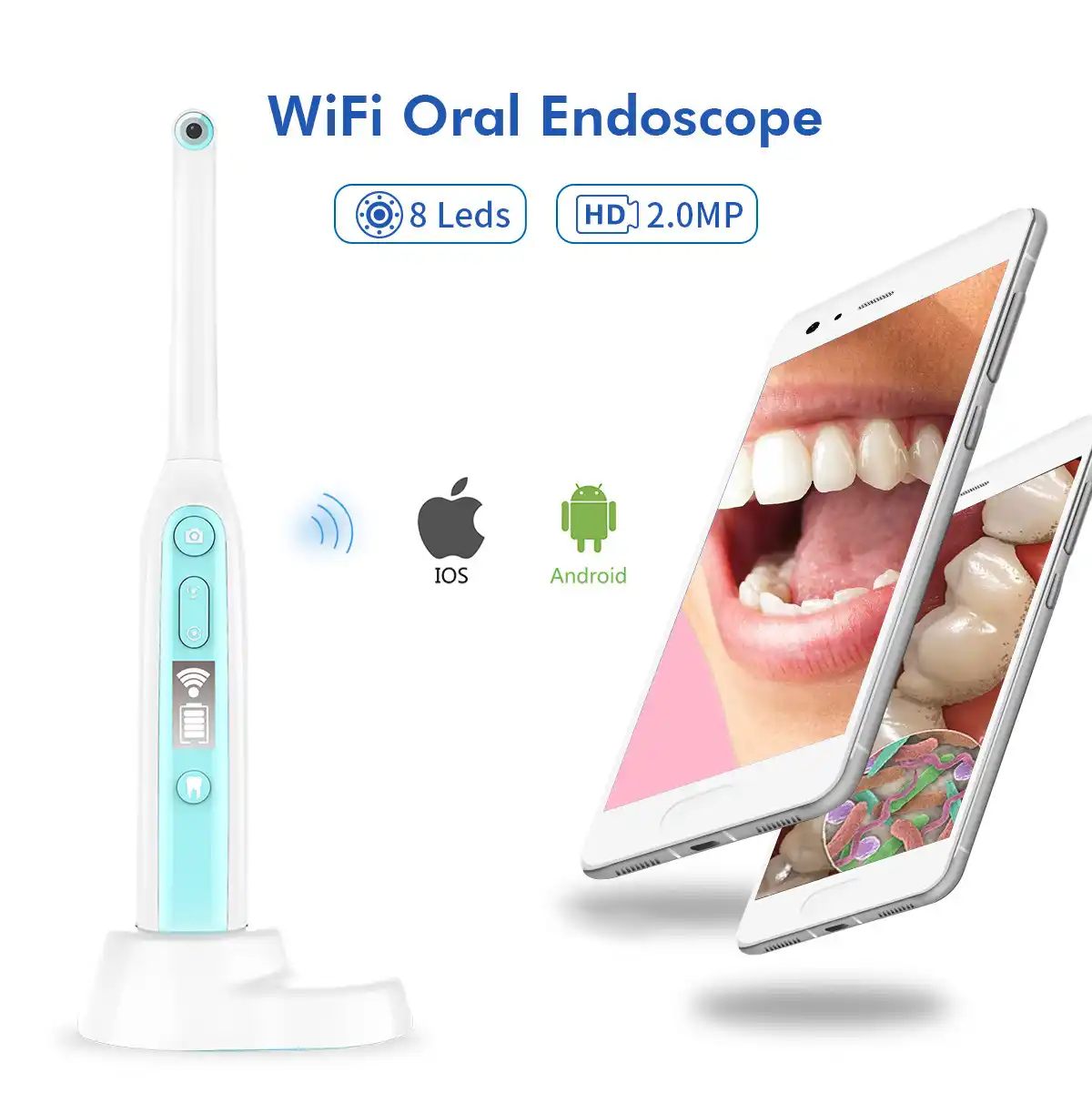 Endoscopio oral visual: requisitos t&eacute;cnicos y tendencias de desarrollo futuro para m&oacute;dulos de c&aacute;mara para endoscopios